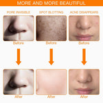FOREVERLILY™ V2 : Masque de Luminothérapie pour le visage et le cou